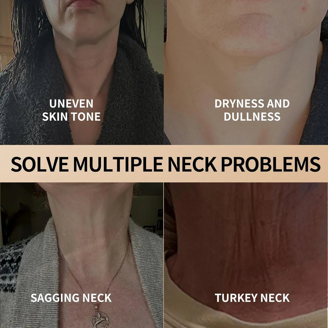 Eloyrah™ - Lifting & Tightening Neck Cream