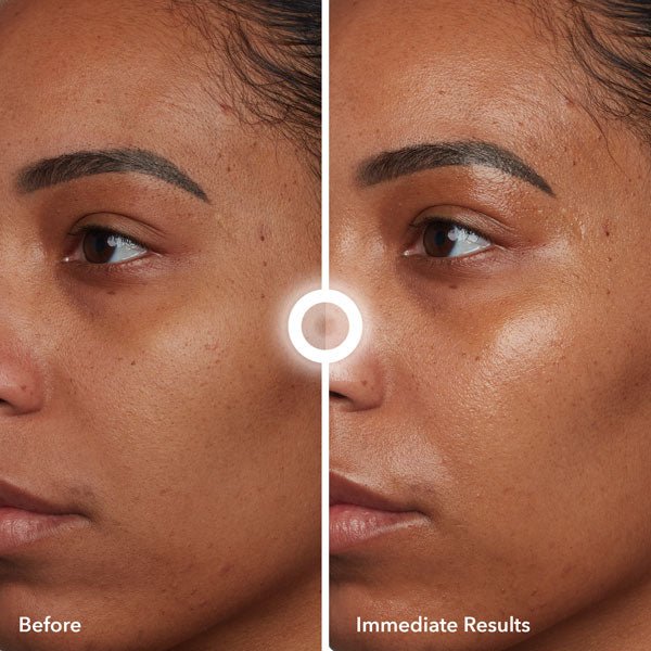 Eloyrah - 3% Hyaluronic Acid Serum