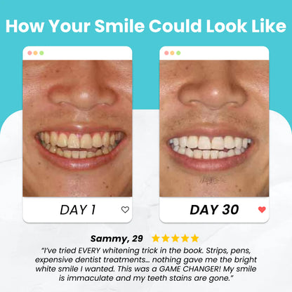 Self-Brushing Toothbrush